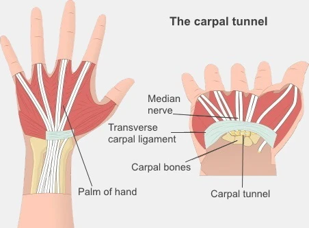 Anatomic illustration showing the median nerve passing through the carpal tunnel into the hand.